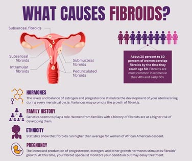 Causes of Fibroids