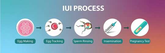 process of IUI